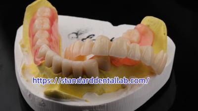 Cina Alta estetica dentale TCS Valplast Flessibile protesi parziali di laboratorio dentale Valplast Chiusura rosa in vendita