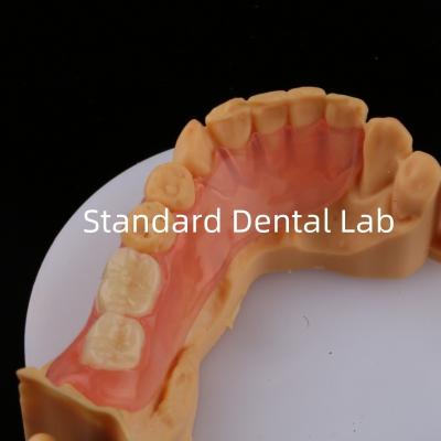 China Dientes de Ace Rosa/Oscuro TCS Valplast Dentaduras parciales flexibles para alta estética Modelo de impresión 3D dental en venta