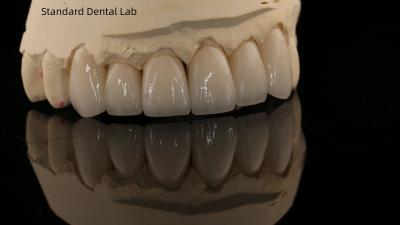 China Full Contour Zirconia Crown and High Aesthetic Natural Dental Bridge 5 Year Guarantee for sale