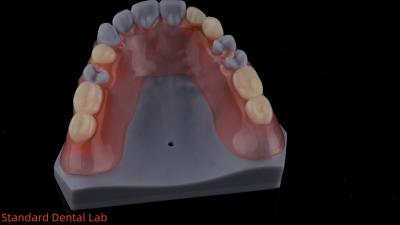 China 3D Print Model High Esthetics Dental TCS Valplast Flexible Partial Dentures Dental Lab for sale