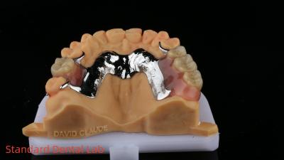 China CorCr Metal Partial Denture High Light Beryllium Free Ivoclar Scheftner Comfortable Metal Framewrok for sale