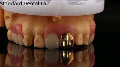 China Full Acrylic Dentures With Yellow Gold Teeth/Dental Temporary Acrylic Denture Ivoclar Professional FDA Approved for sale