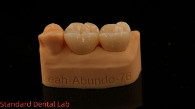 China Solid Dental Lab Crowns 3D Pro High Translucency Full Zirconia Crowns China Dental Lab for sale