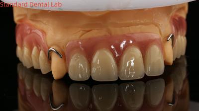 China Heat Cured Ivoclar Partial Acrylic Denture Dental Lab High Accuracy with 3D print model for sale