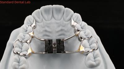 Cina Espansione del palato con arco di denti Stabile Hyrax Espansione del palato perfetta adattazione SDL Apparecchio di ortodonzia di laboratorio dentale in vendita