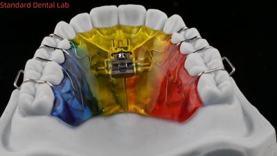 China Dientes de expansión y desestalización ortodoncista paladar expandir China laboratorio dental en venta