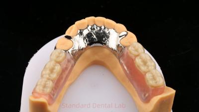 Cina Leghe di metallo Cobalto Cromo Dentiera parziale Ivoclar Scheftner Confortevole Cornice in metallo fuso in vendita