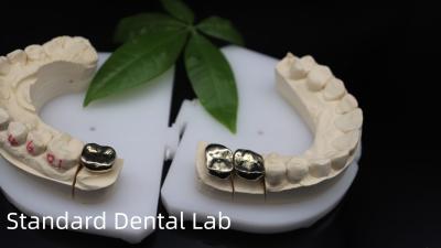 China Professional ISO and FDA Approved Yellow Gold Crown for Dental Lab Shipping UPS Or Fedex Production Time 2 Days for sale