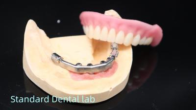 China Titanium Implant Supported Dentures Precise Ivoclar Denture Over Implants for sale