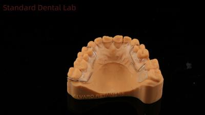 China Perfecto ajuste Alemania Ortodoncia Dentes Halley retenedor para la estética y el ajuste de sombra clara SDL Dental Lab en venta