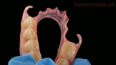 China Dental TCS Valplast Dentes parciais flexíveis Laboratório Dental Impressão 3D Modelo Alta Estética à venda