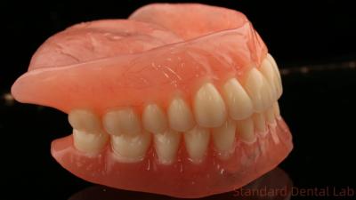 China Heat Cured Ivoclar Full Acrylic Denture Dental Lab High Accuracy High Esthetic Advantage for sale