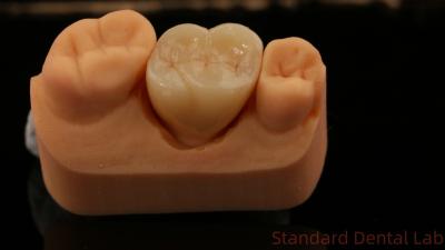 China Mill and Centring Full Zirconia Crown , China Dental Lab Fast Delivery for sale