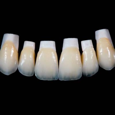 China High Translucency Emax Porcelain Veneers Crown with Better Materials by Ivoclar Vivadent for sale