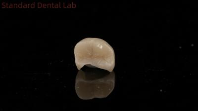 China Translucency Dental Zirconia Crown Inlay Onlay Crown For Restore Natural Cavity Shape for sale