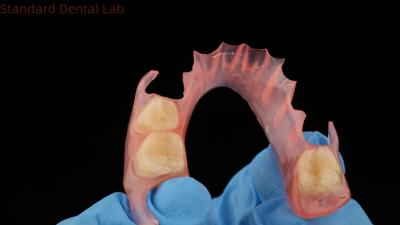 Chine Modèle d'impression 3D dentaire TCS Valplast Dentures partielles flexibles de couleur rose / foncée Produit de laboratoire dentaire à vendre