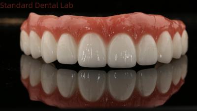 China High Quality Dental zirconia crown and All On Four Six Implant Full Arch / China dental lab Manufacturer for sale