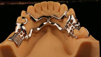 China Upper Cast Metal Framework Partial Dentures Strong Lightweight And Durable for sale