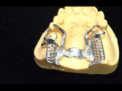 Metal Alloys Partial Cobalt Chrome Dentures Ivoclar Scheftner Comfortable China Dental Lab