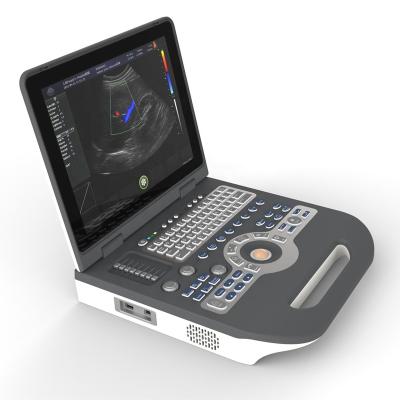 China Metal 15inch Led 128 Elements 2D 3D 4D Color Doppler Notebook Ultrasound Scanner Echo Machine for sale