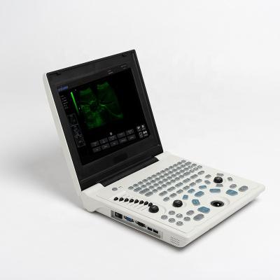 China New Good Quality Plastic Image 12 in LED Screen Notebook B Ultrasound Scanner Machine with libattery for sale