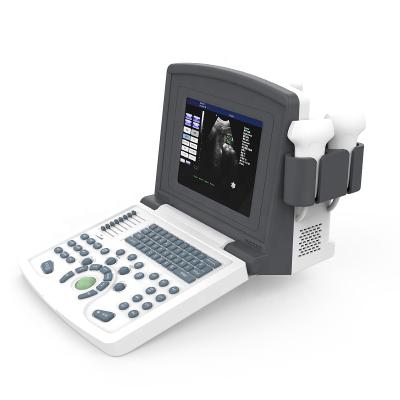 China New Released Black And White Metal Ultrasound Ultrasound Machine Portable Scanner for sale