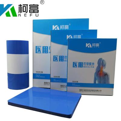 China X-ray room. X-ray service | Cheap Blue X Ray Film PET Medical Dry Film For Health Care for sale