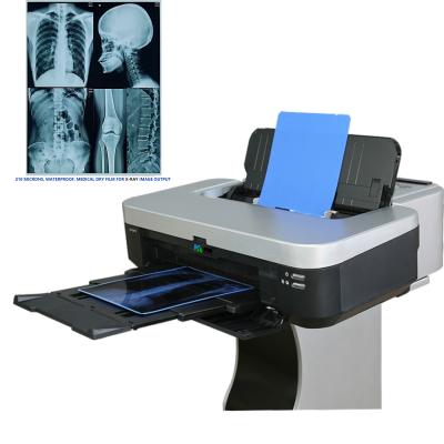 China X-ray room. X-ray service | medical dry x-ray film 210 micron inkjet film blue film for sale