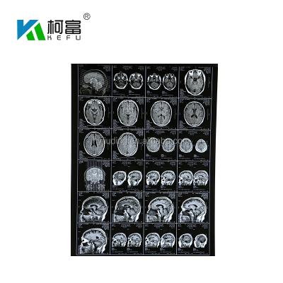 China Waterproof medical x-ray film for Agfa 5302 for sale