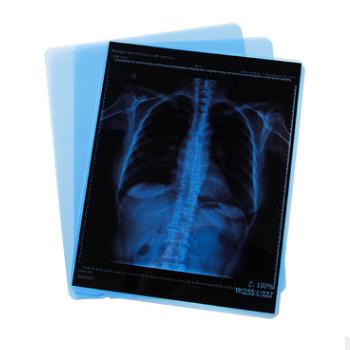 China CT Agfa/Fuji 8*10 Medical Thermal Film Base X-Ray Blue Film, Substitute 14*17inch for sale