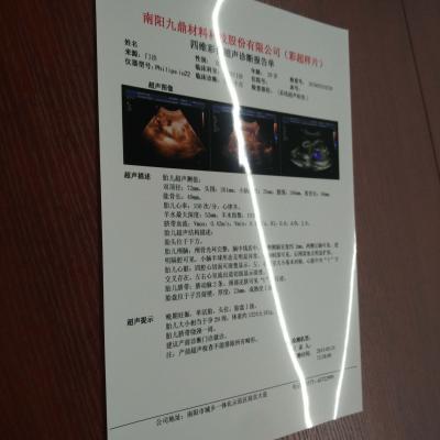 China 180microns Inkjet Medical White Film Medical PET X-Ray Film For Ultrasound Report Radiology for sale