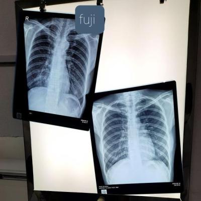 China X-ray room. X-ray service | hot selling x ray film china high quality medical dry ct scan thermal film suitable for fuji3500, 2000, 1000printer for sale