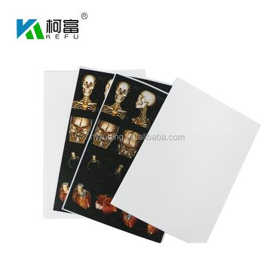 China Medical White A4 Radiography Inkjet X Ray Film Sheet For Inkjet Printer for sale