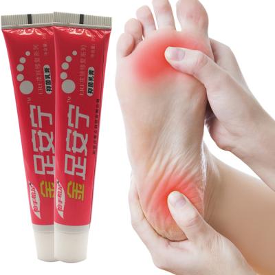 China Foot Psoriasis Ointment Sweaty Smell Psoriasis Ointment Erosive Beriberi Foot Corn Removal Athlete Foot Foot Cream Anti Itchy for sale