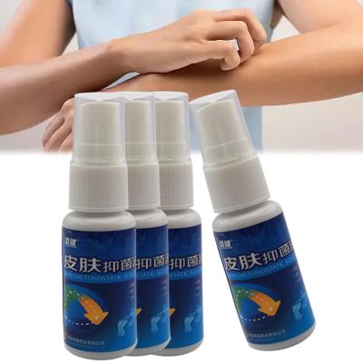 China Body Eczema Herbal Psoriasis Spray Dermatitis Bacteriostatic Athlete's Foot Relieve Irritation Allergies Itchy Skin Care for sale