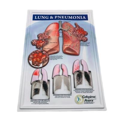 China 3D Embossed /Blister Pack For Wholesale Human Lungs Student Teaching Medical Posters for sale