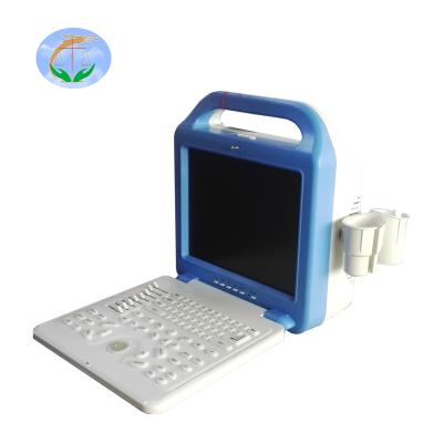 China Portable Black And White Steel Avaible Ultrasound Scanner For Animal And Human for sale