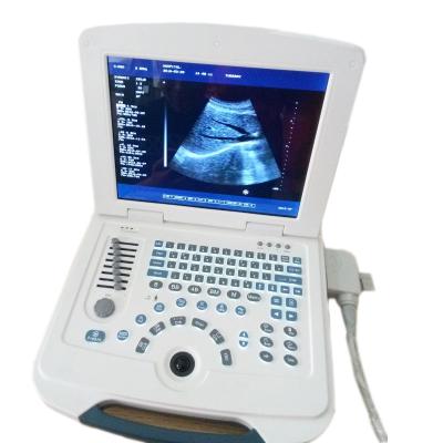 China Steel Easy Operation Multilingual Portable Ultrasound Machine for sale