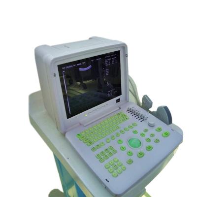 China Factory Price Acrylic Black And White Trolley Ultrasound Medical Ultrasound System for sale