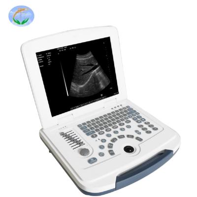 China Hot-selling Handheld Portable Human and Veterinary Diagnostic Equipment Ultrasound Scanner for Pregnancy Abdominal Organ Examination for sale