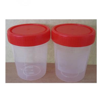 China Plastic Plastic Urine Container 60ml Mold Hospital Urine Container Mold for sale