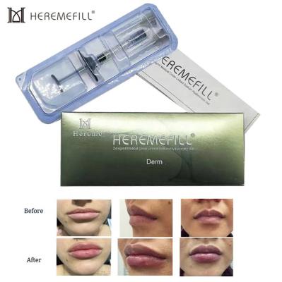 China Hot sale acido hialuronico inyectable dermal lip filler injection hyaluronic acid filler for lip injections for sale