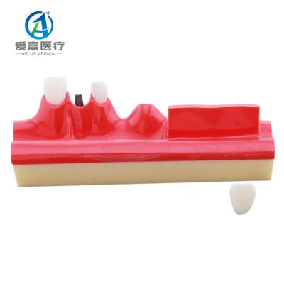 China Hot Selling Educational Dental Model With Best Price Realistic Simulation Implant Oral Analysis for sale