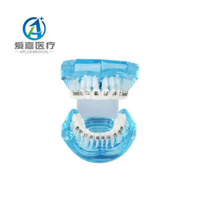 China China Wholesale Vivid Anatomy Oral Typodont With Metal Bracket Orthodontic Model for sale