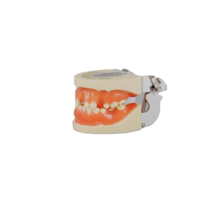 China Realistic Human Simulation Typodont Dental Implant China Manufacturer For Realistic Anatomical Training for sale