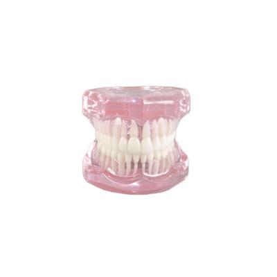 China Factory Price Vivid High Quality Standard Dental Model Anatomy Dental Anatomical Models Transparent Dental Model for sale