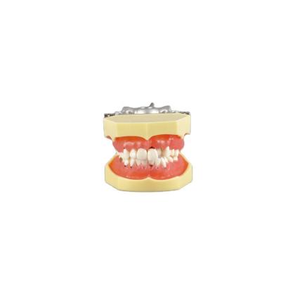 China Realistic Human Simulation Perio Good Quality Periodontal Teeth Model Adult Dental Models for Training with Inflamed Hard Gum and Calculus for sale