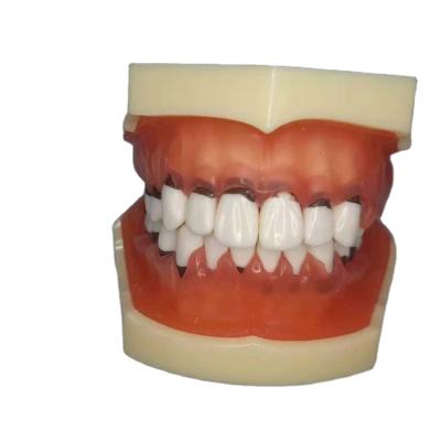 China New Arrival Human Simulation Periodontal Disease Model Typodont Perio Realistic Periodontic Jaw Articulator With Transparent Articulator Dental Gum for sale