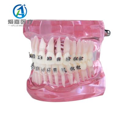 China China Vivid Wholesale Metal Braces Treatment Dental Orthodontic Model With Trade Assurance for sale