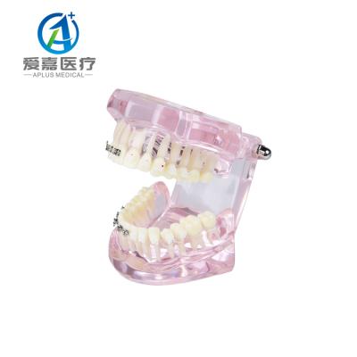 China Wholesale Vivid Anatomy Orthodontic Teeth Practice Oral Model For Dental Clinic and Hospital for sale